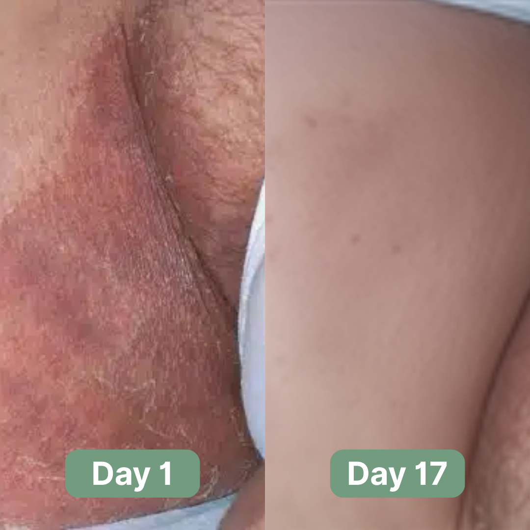 Velaire™ Antifungal Soap