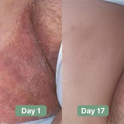 Velaire™ Antifungal Soap