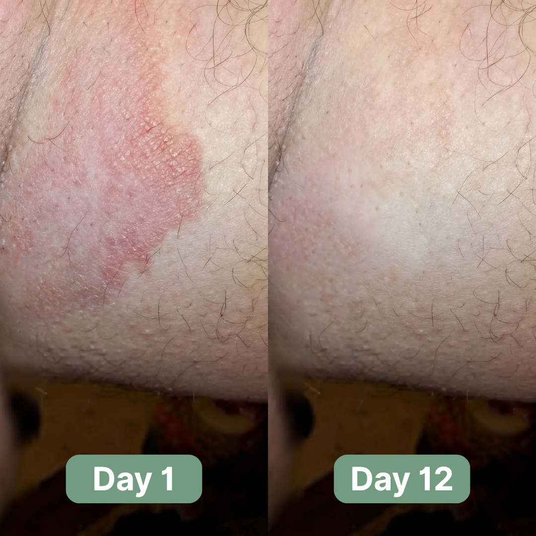 Velaire™ Antifungal Soap