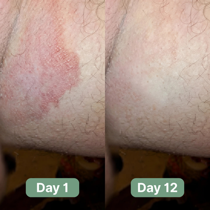 Velaire™ Antifungal Soap